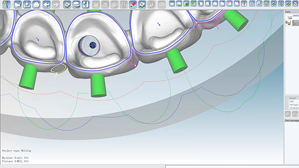 hyper dent.png